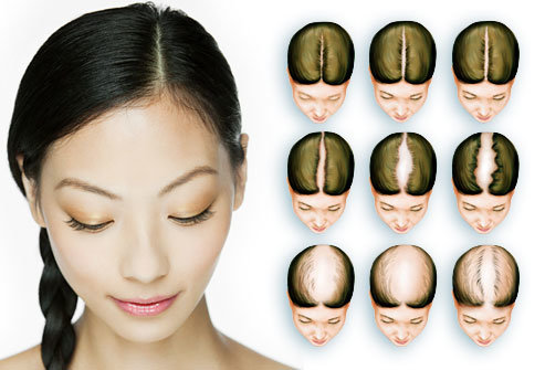 herbal scalp treatments