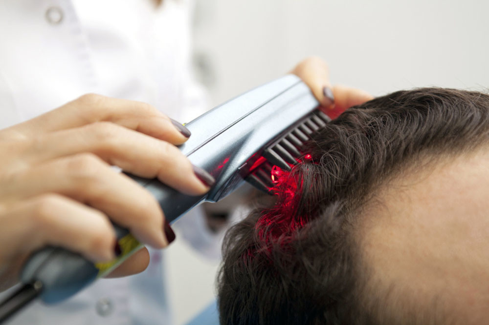 hair loss low level laser therapy