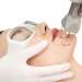 laser-treatment-for-acne