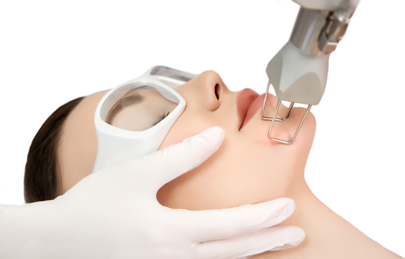 laser-treatment-for-acne