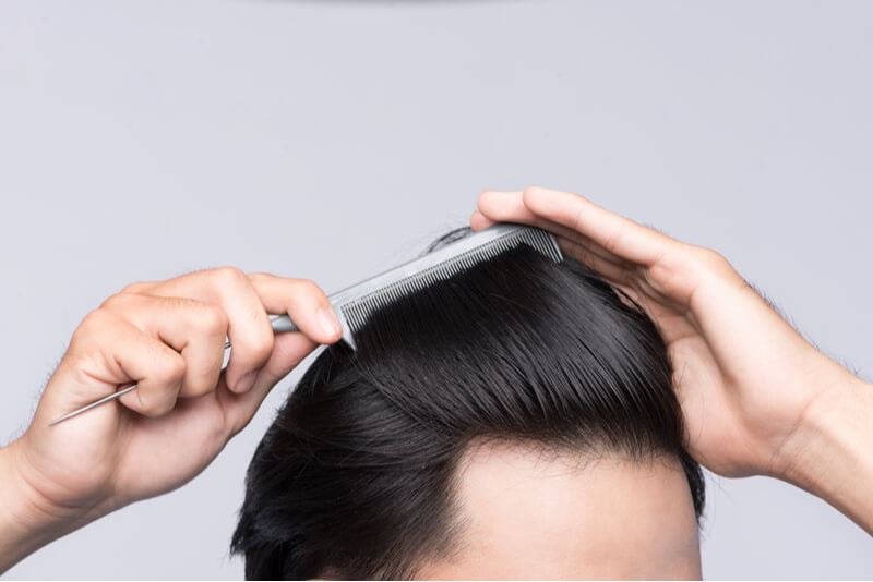 5 Easy Ways to Prevent Hair Loss in Singapore - Singapore Beauty